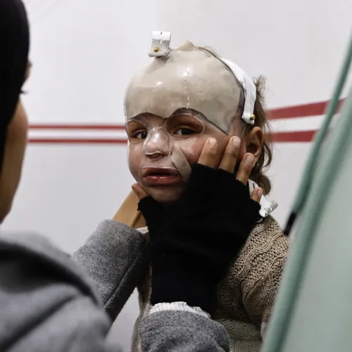 Gezondheidszorg Gaza stort verder in door Israëlische aanvallen en blokkades