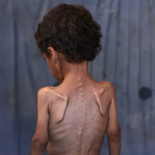 Voedsel of Vernietiging? Elke dag honger in Gaza is onze keuze