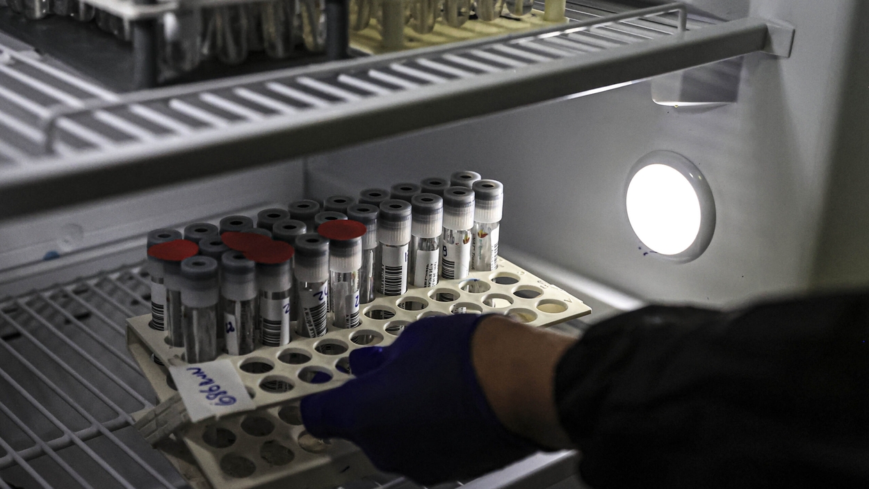 PCR tests process at a hospital of Turkey's Ankara