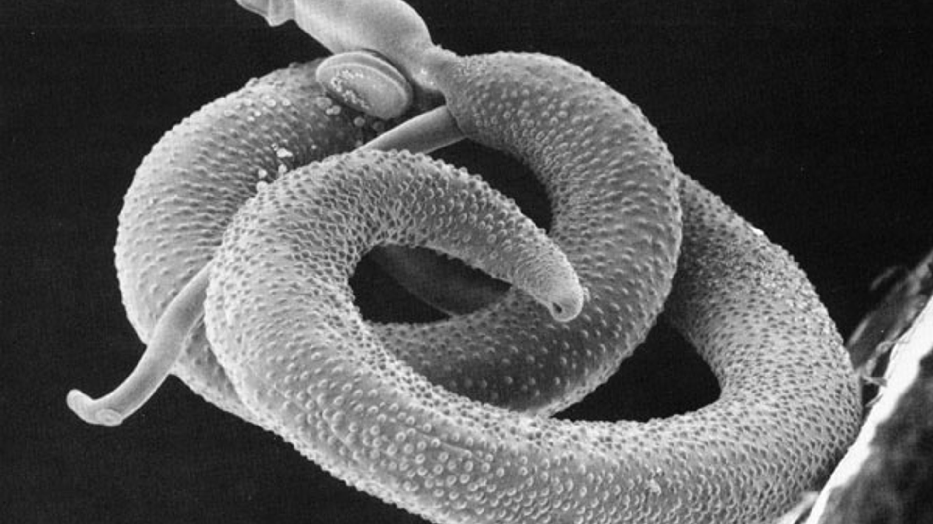 Schistosoma_mansoni2