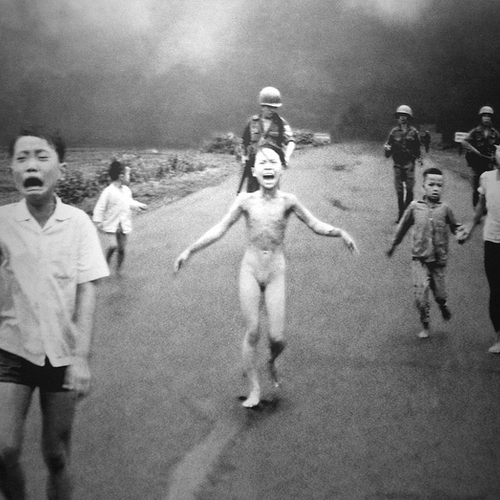 Het bizarre leven van napalm-slachtoffer uit Vietnam-oorlog