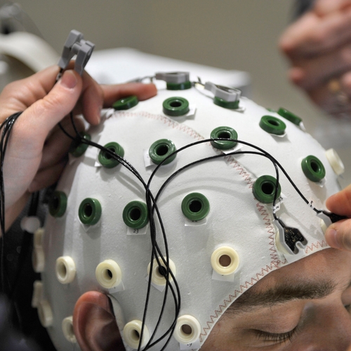 EEG-onderzoek stervend brein: hier denken we aan vlak voor de dood
