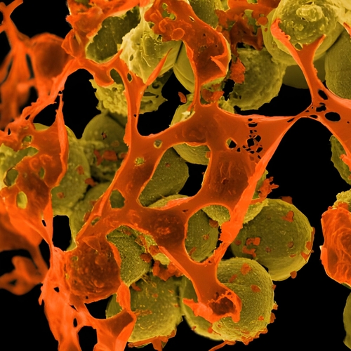 Afbeelding van Onbehandelbare bacteriële infecties nu dodelijker dan hiv of malaria