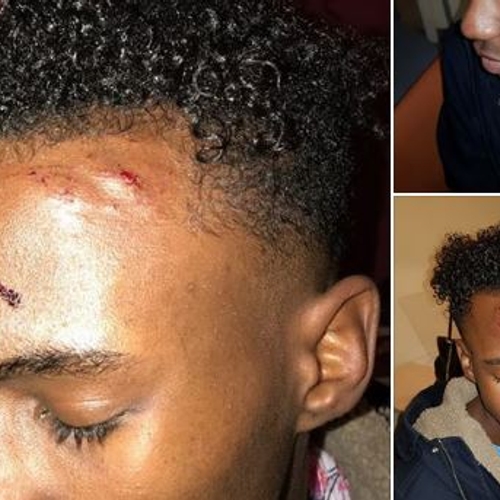 Afbeelding van Zwarte jongen (17) loopt hoofdwond op bij onterechte arrestatie