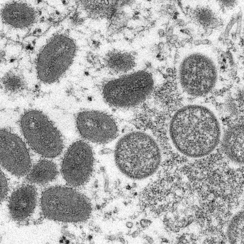 Afbeelding van Kans dat Europa niet meer van apenpokkenvirus afkomt
